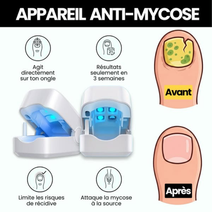 Orthovital Pro™ – Appareil LED pour le soin des ongles à domicile