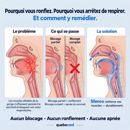 Silenco | Appareil Anti-Ronflement Intelligent TENS | 3 Intensités, Rechargeable