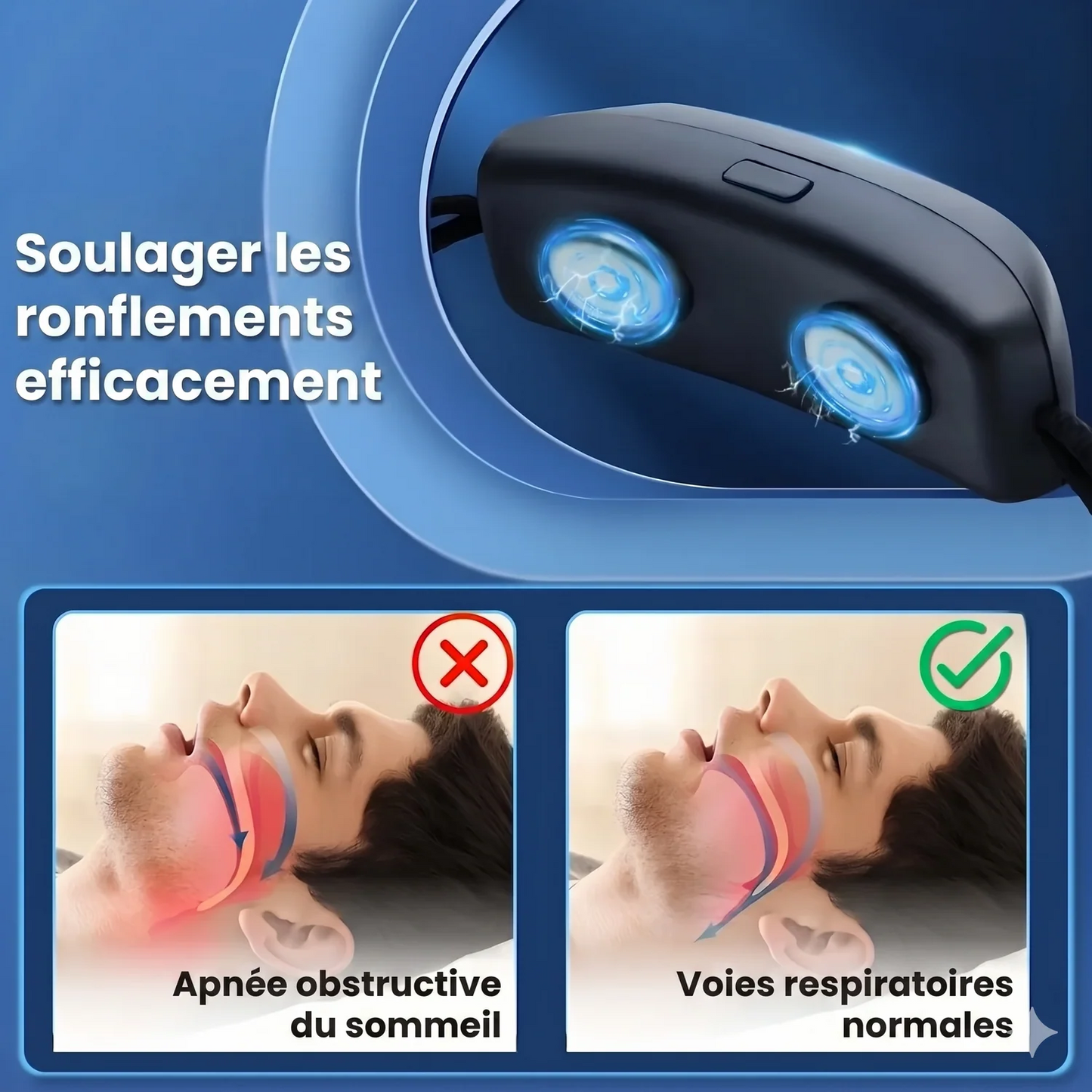 SnoreEase™ — Dispositif anti-ronflement pour des nuits plus paisibles